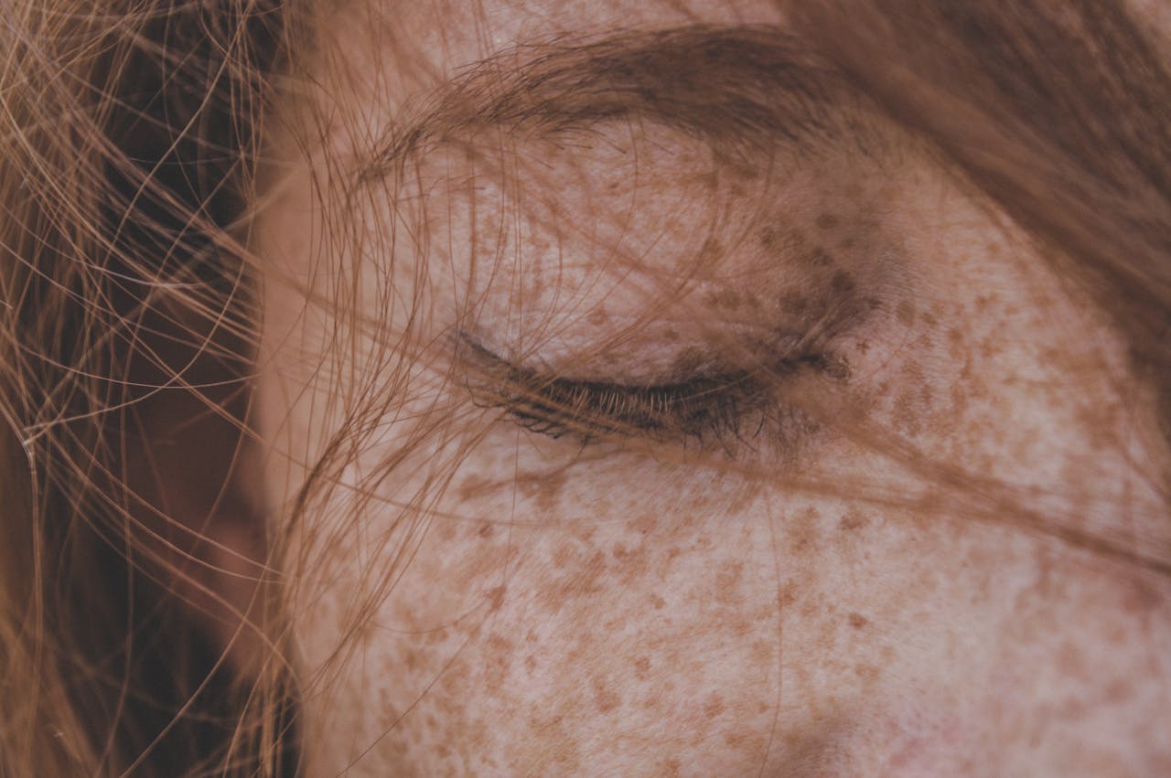about-02 Detailed close-up of a freckled face with closed eye and hair, highlighting skin texture.